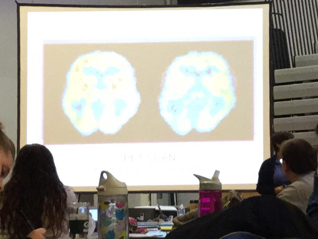 dr_hartin's tweet image. Neuroscience #teacher problems #OPSEdTech