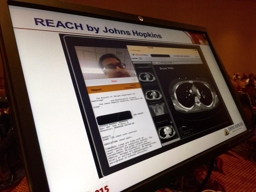 Great example of #mhealth collaboration by <a href="/Gorkem_Sevinc/">Gorkem Sevinc</a> #SIIM15