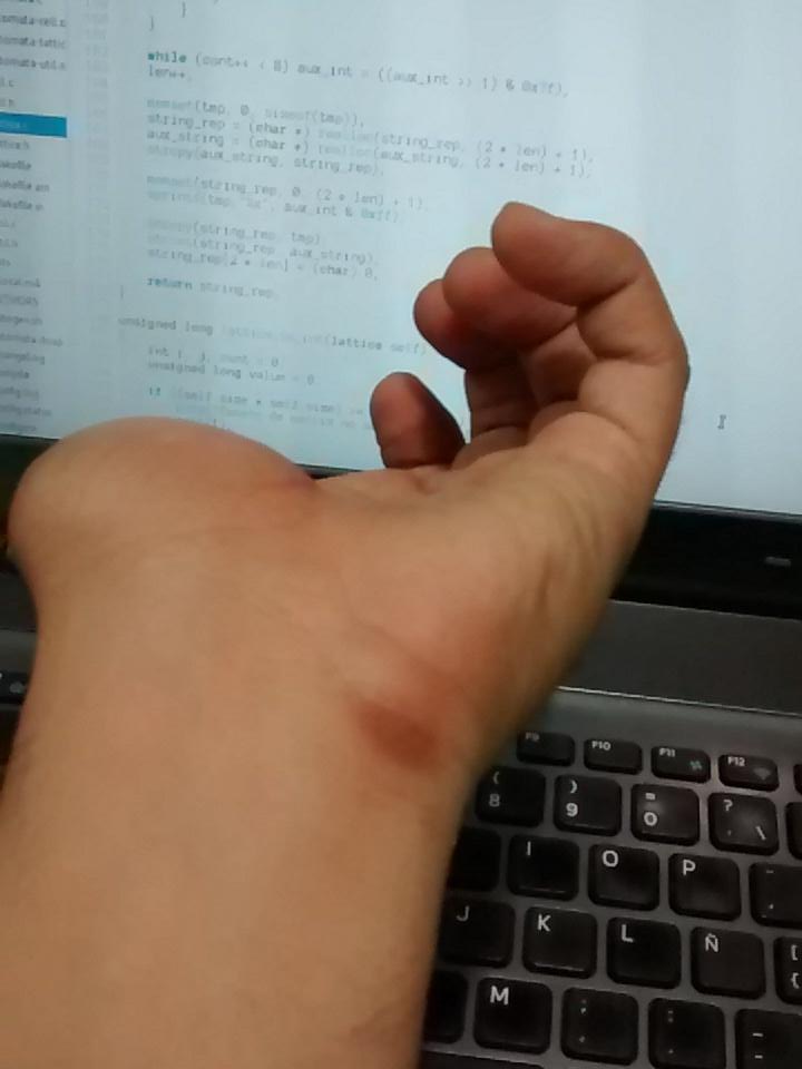 ibadwolfie's tweet image. Damn! Coding much, bro? #DevelopersProblems