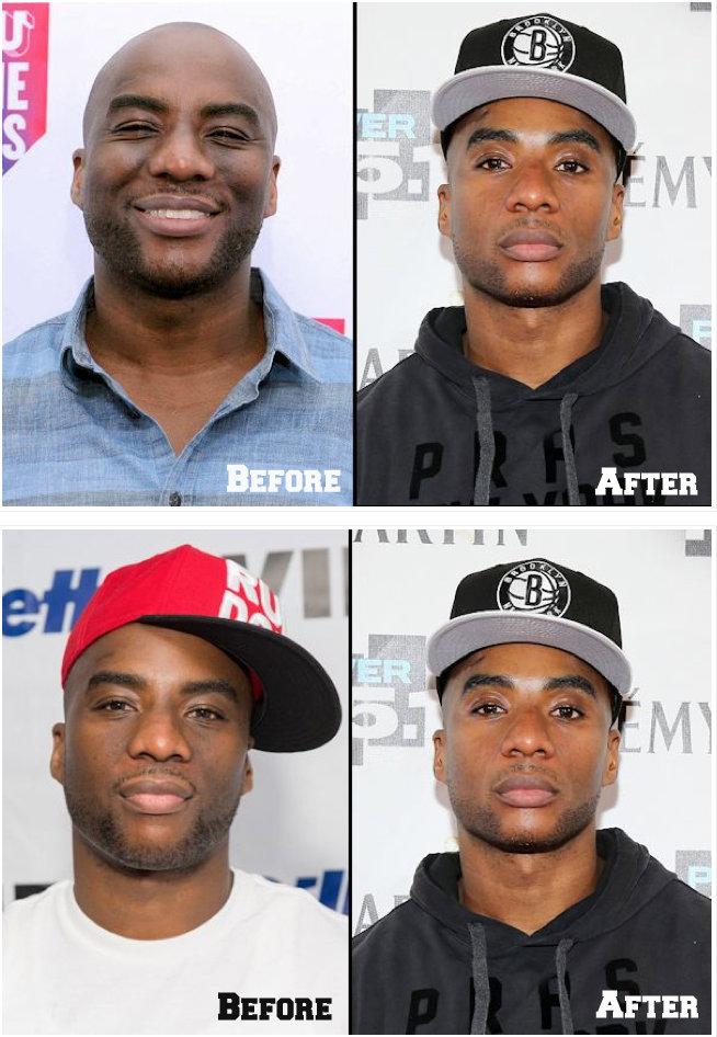 xonecole's tweet photo. Charlamagne's dermatologist dispels rumors of skin bleaching once and for all [VIDEO] http://t.co/UQQE1iWRKO http://t.co/lmIFqR8vLm