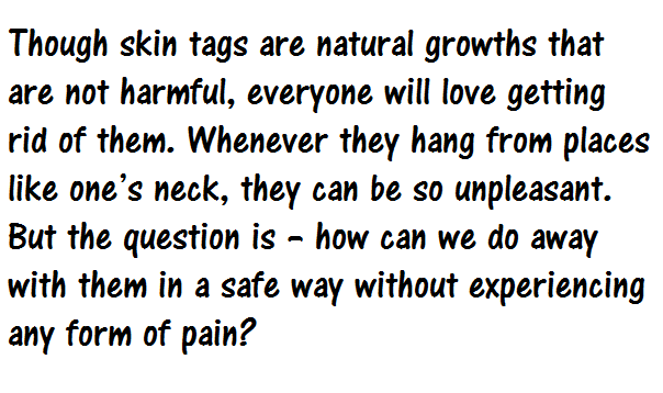 CuteCatPix's tweet image. How To Quickly Remove Skin Tags With The Help Of Only One Ingredient bit.ly/1Ks7G3N