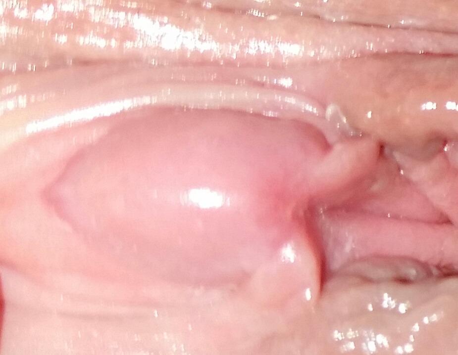 sam_samswallows's tweet photo. #pissing #waterworks #peeingfetish #juicyclit #funbutton #bigclit http://t.co/4bFpdYiGRw