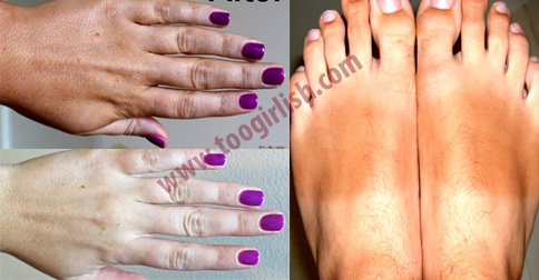 TooGirlish's tweet image. How to Remove Sun Tan From Your Body Quickly
goo.gl/xvHGwd
#removeSunTan #suntan #darkspots #remove