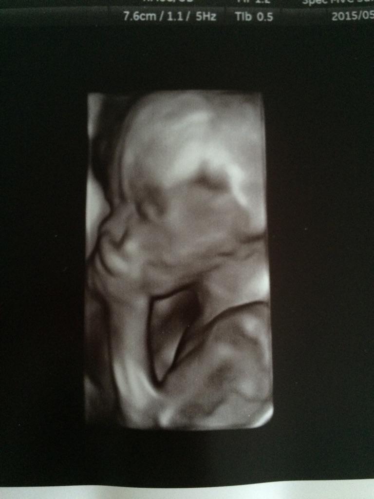 tessoness's tweet image. My sisters twins, im so happy &amp;lt;3