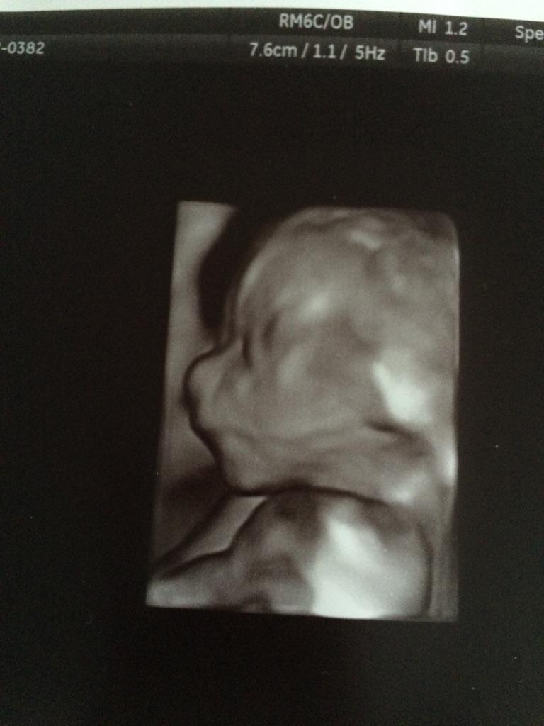 tessoness's tweet image. My sisters twins, im so happy &amp;lt;3