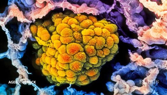 el_pais's tweet photo. Importante avance contra el cáncer a partir de la inmunoterapia http://t.co/2V4NJNGuyJ en @materia_ciencia http://t.co/kDUKYgLmc4