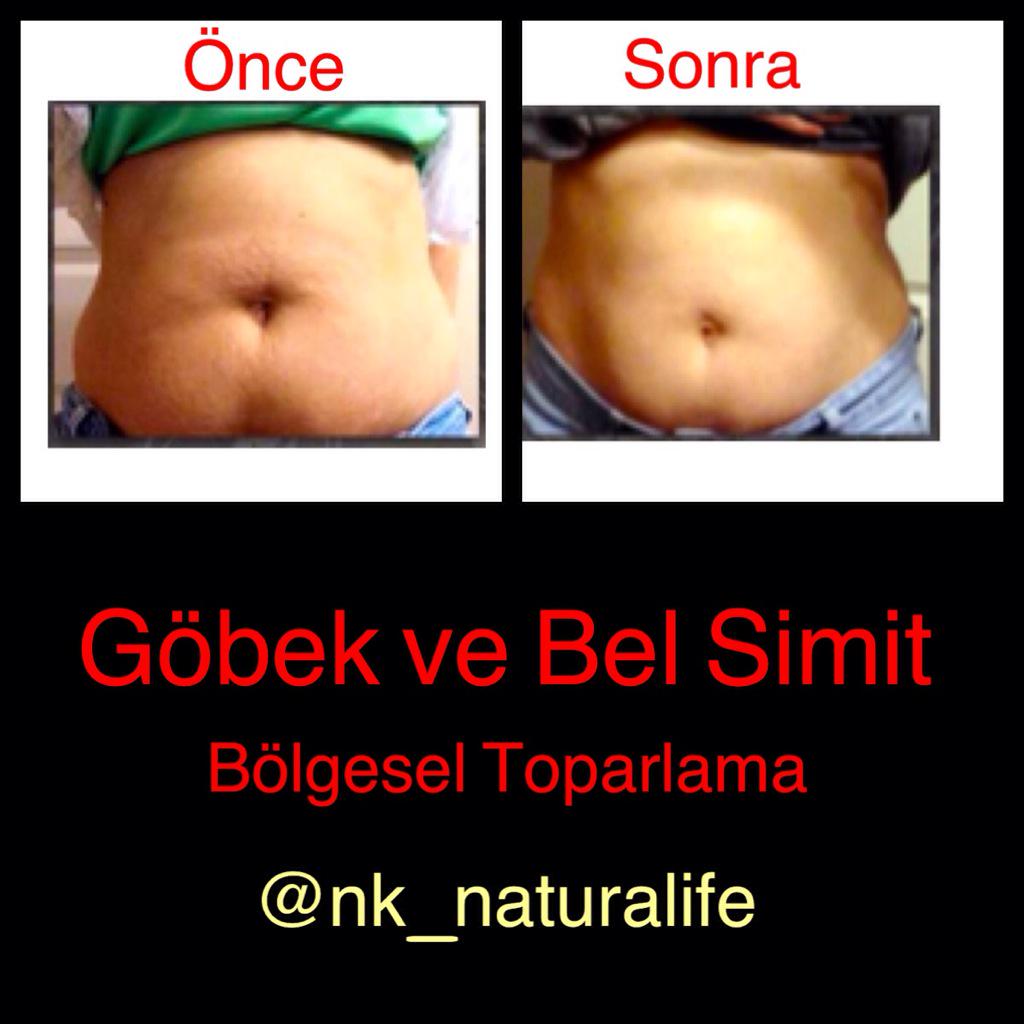 Bölgesel İncelme Toparlama Set Sonucu #zayıflama #incelme #çatlak #selülir