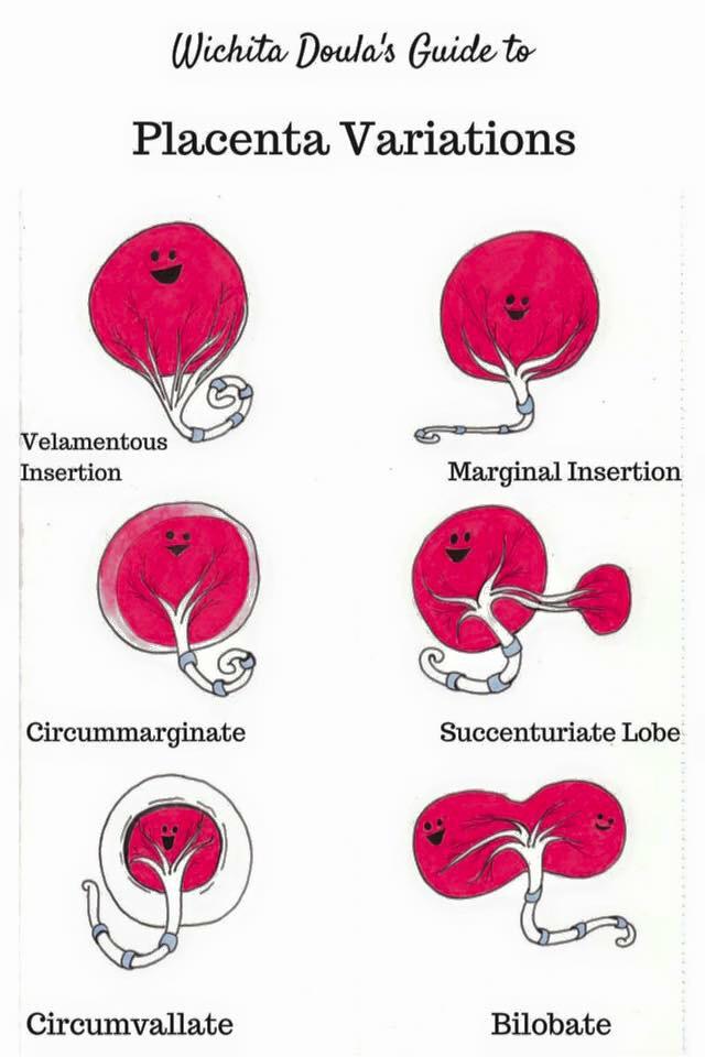 Cartoon With Extreme Anal Prolapse Telegraph