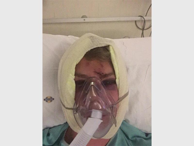 RekordNewspaper's tweet photo. NATIONAL NEWS: Man #horrifically beaten at #Fourways club http://t.co/cabbUiQBsT http://t.co/B6aLkONlY8