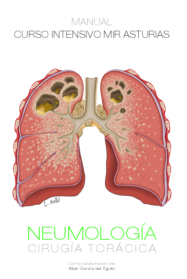 Capítulo de Insuficiencia respiratoria de nuestro libro de #Neumología.¡Compártelo! ht.ly/NHnrn
