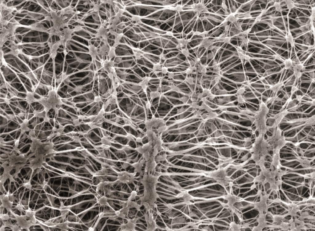 Krowmark's tweet photo. Wondering how waterproofs work? Here's a #microscopicimage of Gore-Tex fibres! Get yours here: http://t.co/L0QNZHWda1 http://t.co/EqRgQTyIQ7