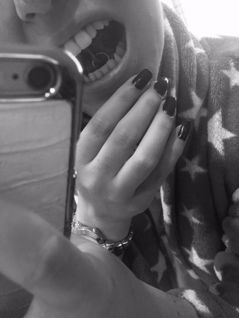 atlantaallen_'s tweet photo. #webpiercing ๐
๐
๐
http://t.co/za1nk8bSjk