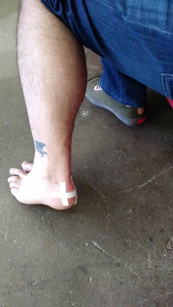 RyanBethencourt's tweet image. Benefits of being a mentor @indbio when you get a blister, you get a @Bio_Loom biobandage @worksonmypc