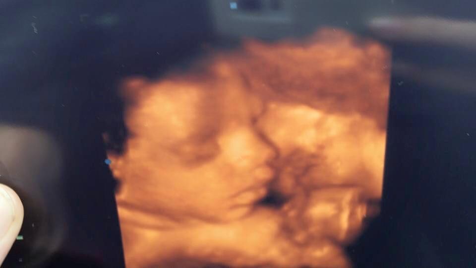 Benjamin Blom tweet media