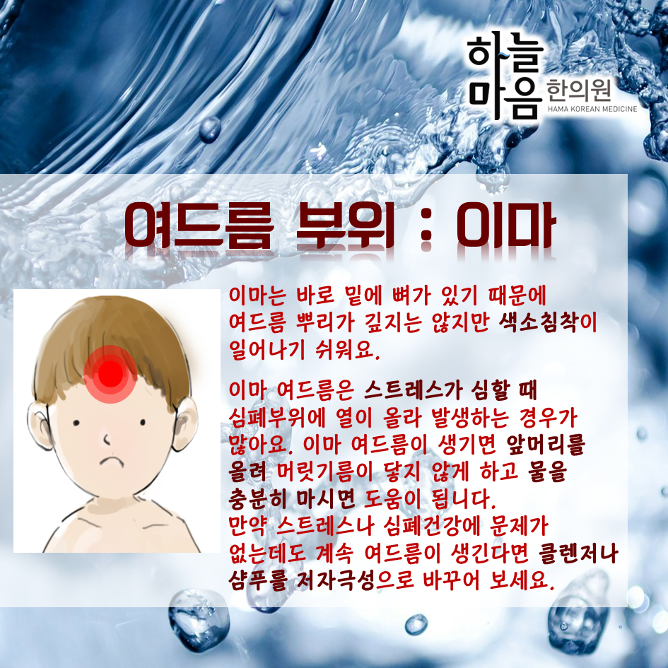 skin8575's tweet photo. 관리하건 안하건 벗어나기 힘든 #여드름 #부위별여드름 의 발생원인과 소소한 관리법을 알아보아요~ http://t.co/ARq9Lla0Kw