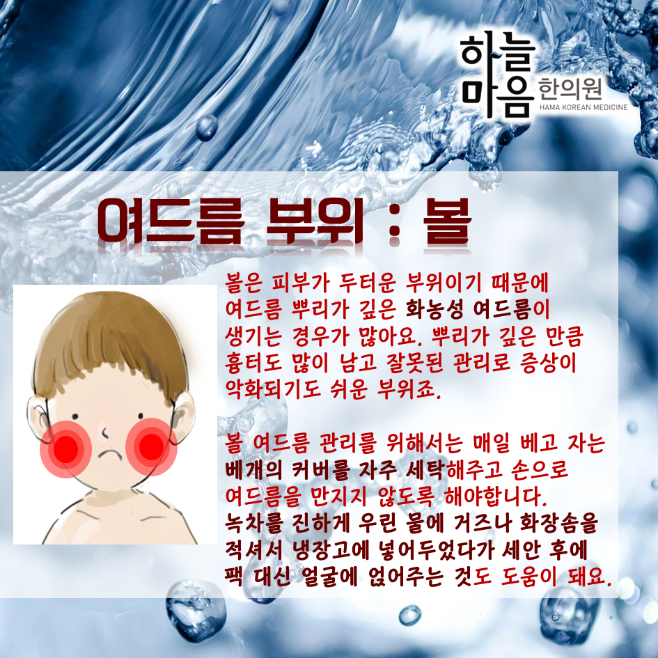 skin8575's tweet photo. 관리하건 안하건 벗어나기 힘든 #여드름 #부위별여드름 의 발생원인과 소소한 관리법을 알아보아요~ http://t.co/ARq9Lla0Kw