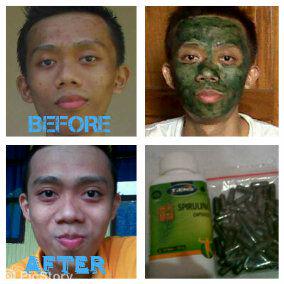 DoktermaskerID's tweet photo. Siapa yg gamau dlm waktu sebentar dan harga terjangkau bs dapatkan kulit sesuai impian km, yuk invite Pin: 56A0A677 http://t.co/1P3veMF3N3