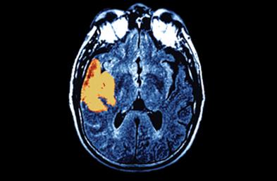 123MYMD's tweet image. Migraine Headaches Affect More Women than Men 123mymdblog.com/2015/06/02/mig…