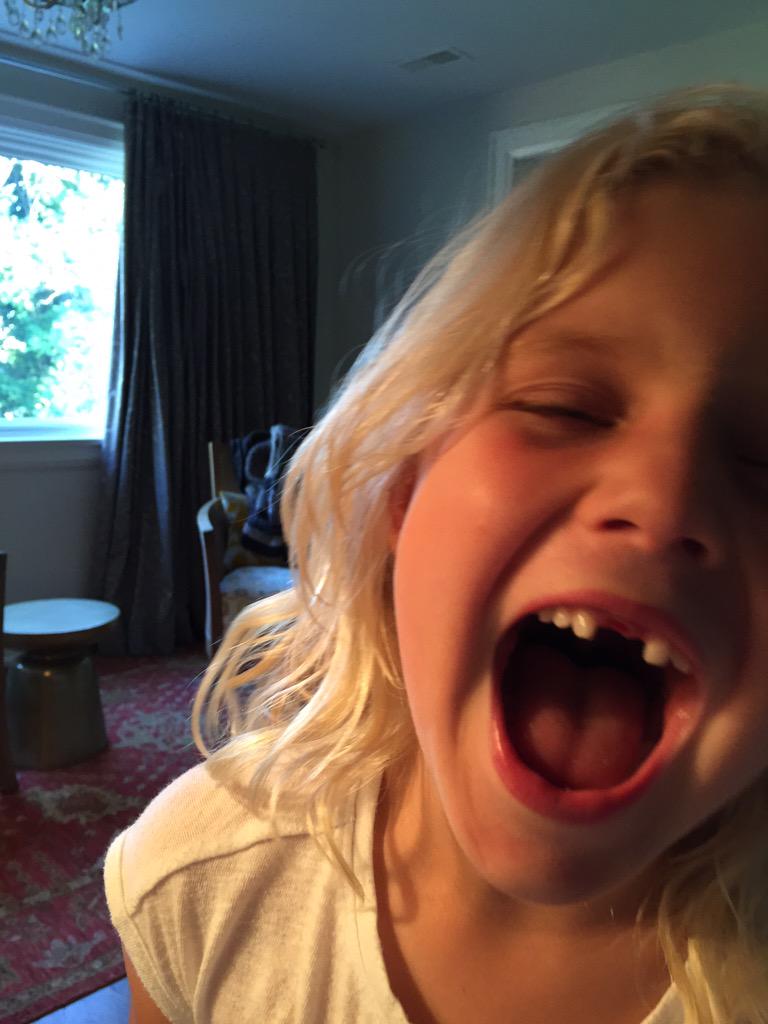 SueMacDonaldYWG's tweet image. All I want for Christmas #2frontteeth