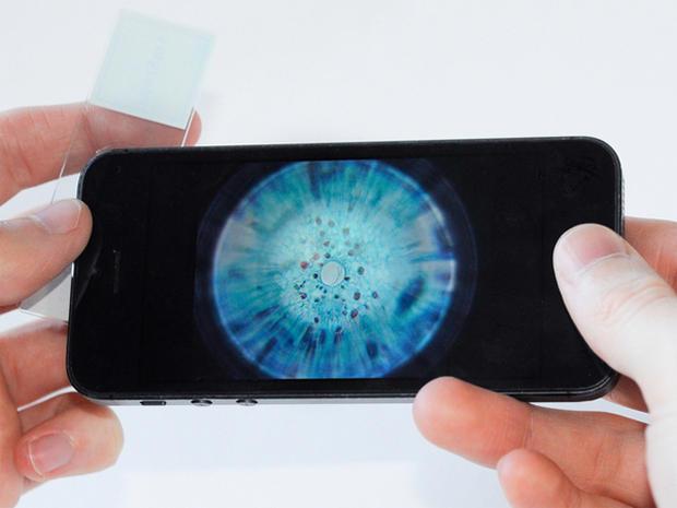 microEYEnz's tweet photo. Turn your smartphone into a high-powered microscope (for less than the cost of a piece of gum) http://t.co/AK4wq1FTkx http://t.co/TrrVGBmwqJ