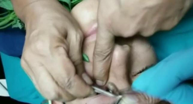A3Noticias's tweet photo. Extraen una larva del ojo de un joven de 17 años utilizando albahaca como cebo [VÍDEO] http://t.co/iau5Gkxcln http://t.co/eQwRgeNqLi
