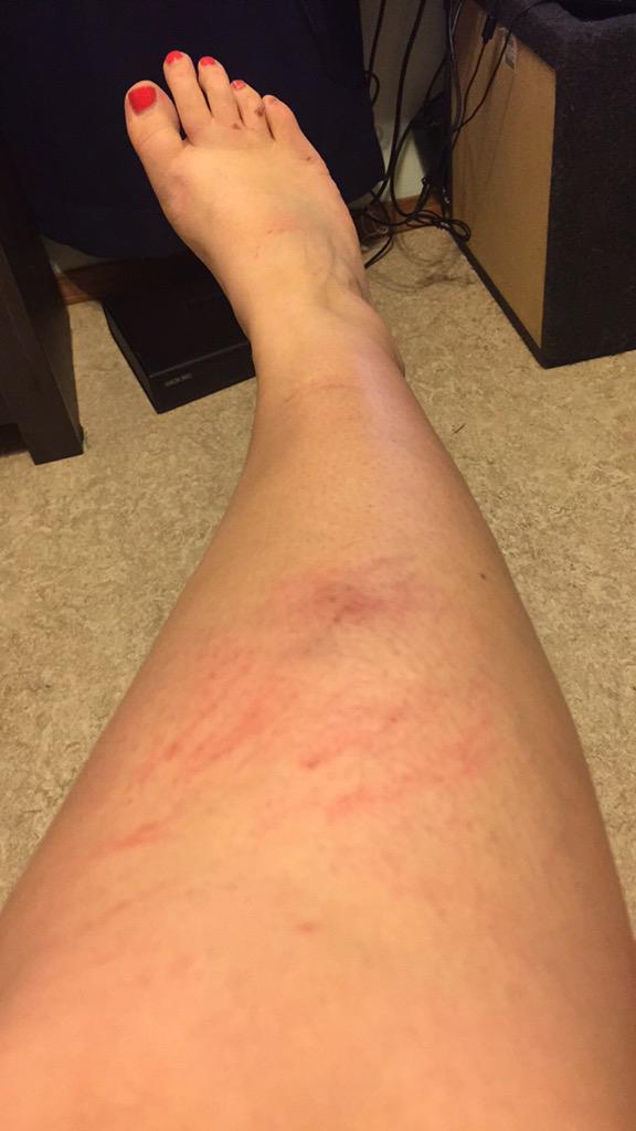 couurtneywillis's tweet photo. Went too hard running from that snake 😅🐍 http://t.co/kXDc7wSjfg