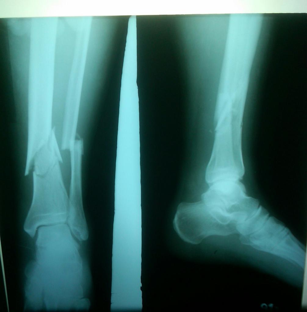 Mohon doa buat kesembuhan ayah dari Boy gitaris Glamore band semoga bisa sehat &amp; pulih dari kecelakaan semalam amin