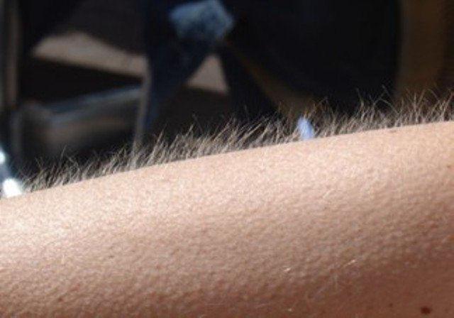 needszanessa's tweet image. #charliebarnes