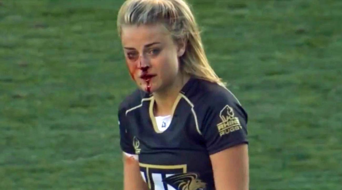 Tvasports A Voir Une Vraie Guerriere Le Nez Casse Elle Plaque Deux Joueuses Http T Co V2wgjtglbh Ouch Http T Co Kwfgptngex