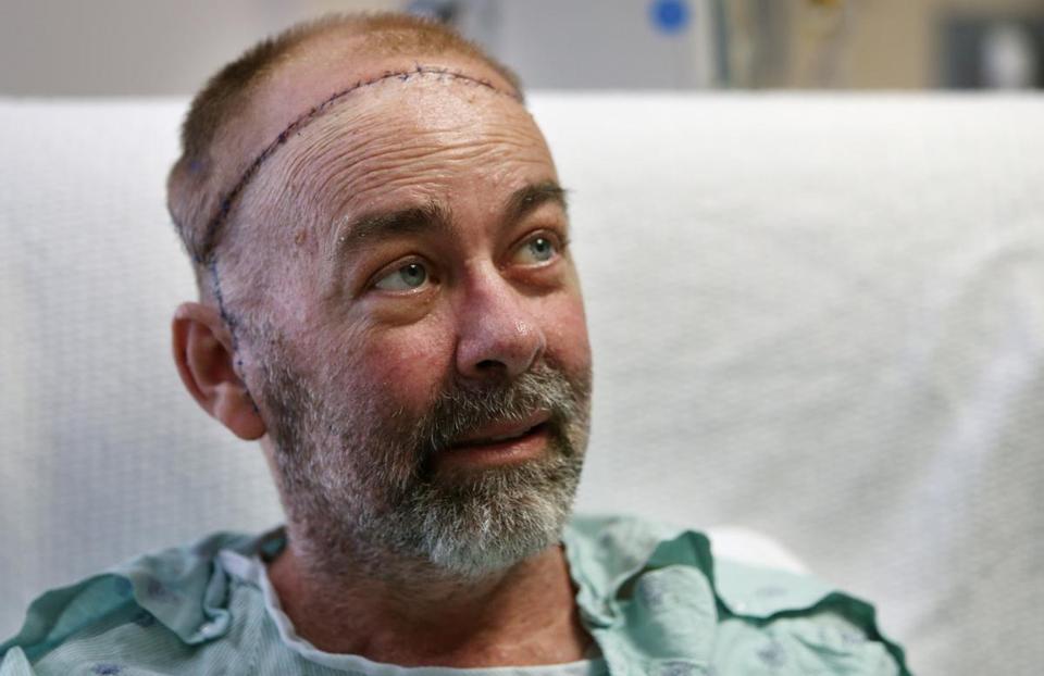 BostonGlobe's tweet photo. Texas doctors have done the world’s first partial skull and scalp transplant http://t.co/LYnmUGVVEm http://t.co/oWs83zfJf2