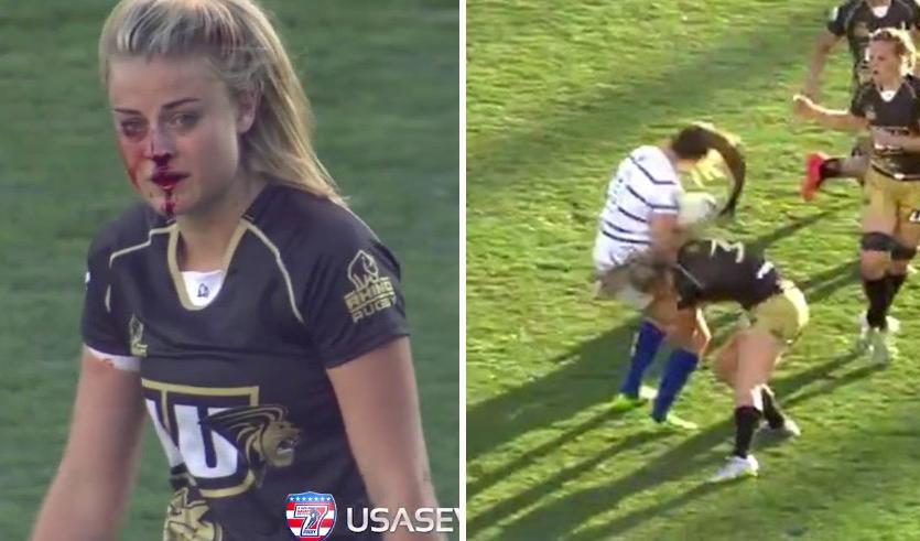 BleacherReport's tweet photo. VIDEO: Rugby player breaks her nose, gets right back up &amp; makes hard-hitting tackle #BeastMode http://t.co/WOl1v6t4ol http://t.co/NljCEAlBgh