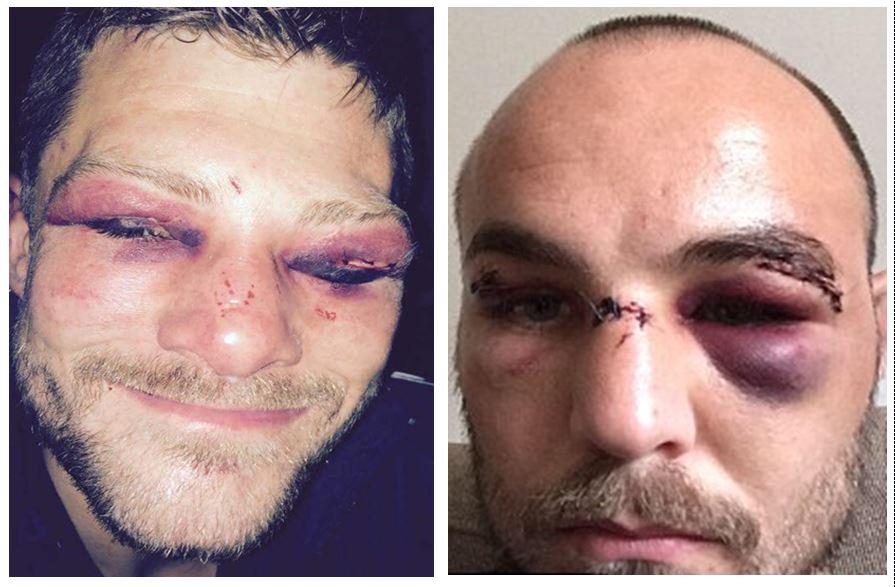 Just watched our fights back, both ad them down but couldn't see from 7th. Good luck 4 the rematch#essex warriors