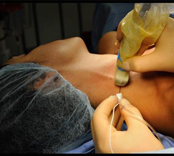 MedicalLOnline's tweet image. Regional anesthesia is not used widely for otolaryngologic surgery.medicallibraryonline.com/?t=Perioperati… #anesthesia