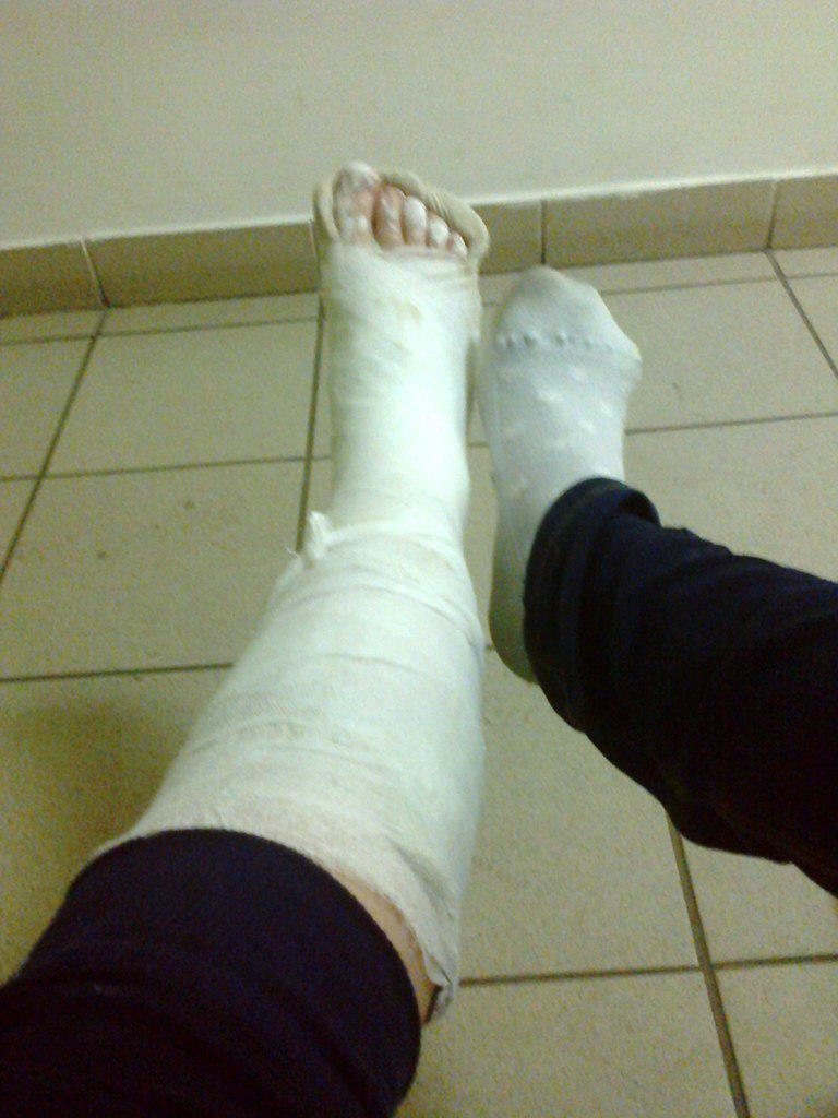 Jenny Frost ends up with her foot in a cast after rare night partying in Ibiza D