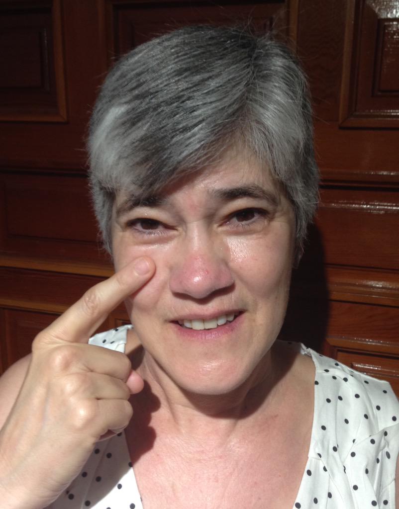 Montserrat Nerin (@montserratnerin) on Twitter photo Yo también #miroporelalbinismo y apoyo esta campaña de sensibilización de <a href="/ALBA_albinismo/">ALBA albinismo</a> <a href="/LluisMontoliu/">Lluis Montoliu</a> <a href="/2EDA_ALBA/">2EDA ALBA albinism</a> Yo también #miroporelalbinismo y apoyo esta campaña de sensibilización de <a href="/ALBA_albinismo/">ALBA albinismo</a> <a href="/LluisMontoliu/">Lluis Montoliu</a> <a href="/2EDA_ALBA/">2EDA ALBA albinism</a>