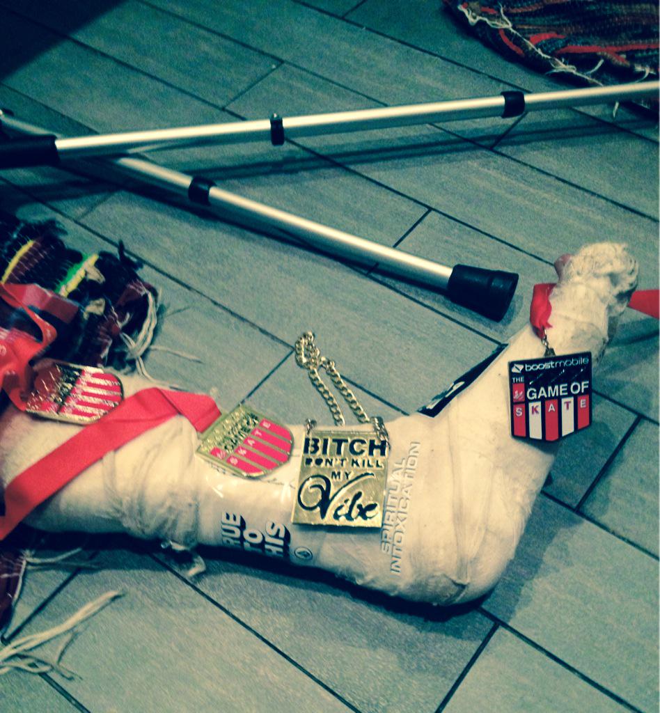 Kamēr citi vinnē sačus, Armands labo kāju!