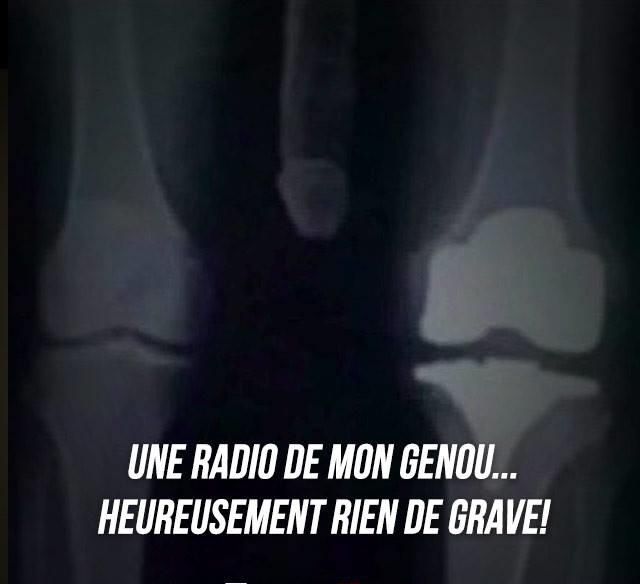 Pleinsdebetises's tweet photo. Une radio de mon genou... Heureusement rien de grave ! http://t.co/9DRoMbbQwA