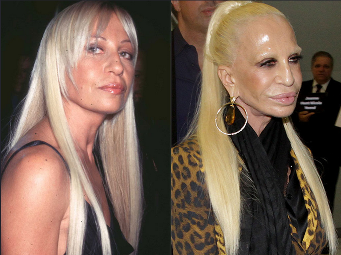 WHATOMGIoI's tweet photo. 10 Celebrities Who Were Unrecognizable After Plastic Surgery (OMG #4 just ruined her life 😲)👉 http://t.co/rQj4qvG1xk http://t.co/VEzcQvCCsg