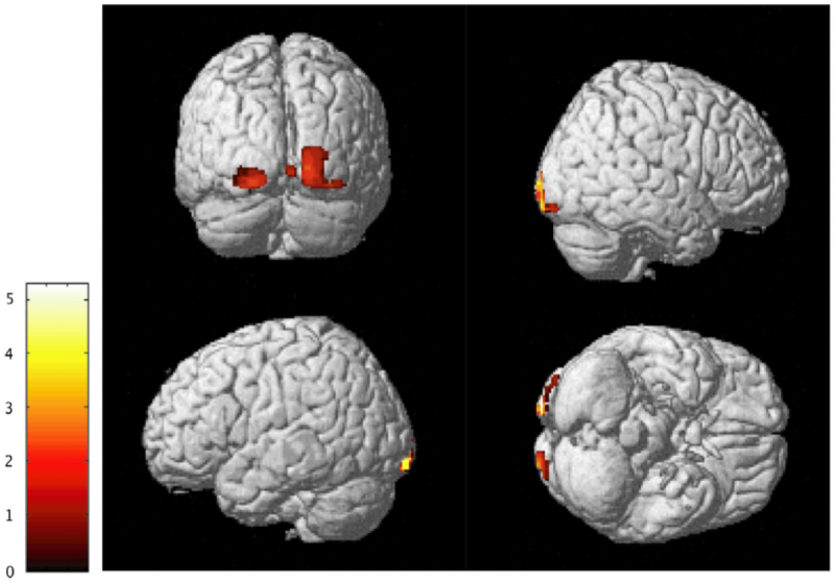 PopSci's tweet photo. Are you empathetic? Your brain might have more gray matter http://t.co/EtdM4fsic8 http://t.co/eXMAUHaopr