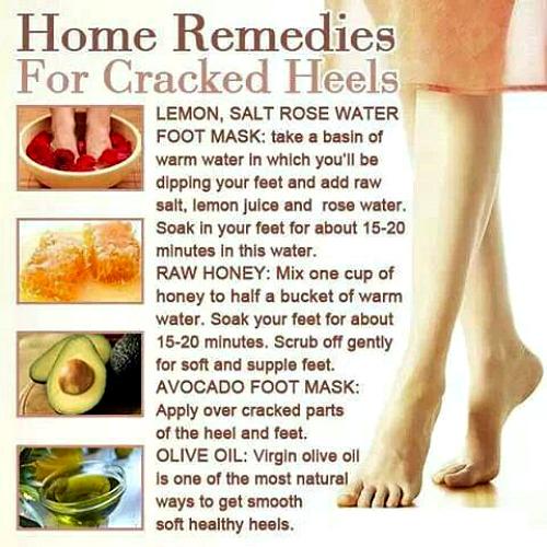 Tote_Gallore's tweet photo. #Summer is here &amp; #sandals are back on the scene! Keep your #heels smooth by trying these #rejuvenating #treatments http://t.co/5kzjHClqHQ