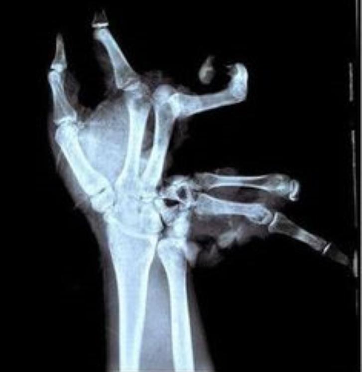 High Five?!?