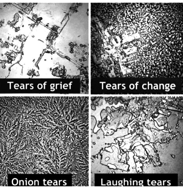 bss_cristy's tweet image. &quot;Todo lo que hace Dios es tan detallado, perfecto, y  personal...&quot; #molecularstructure #tearswecry 
Psalm 56:8
