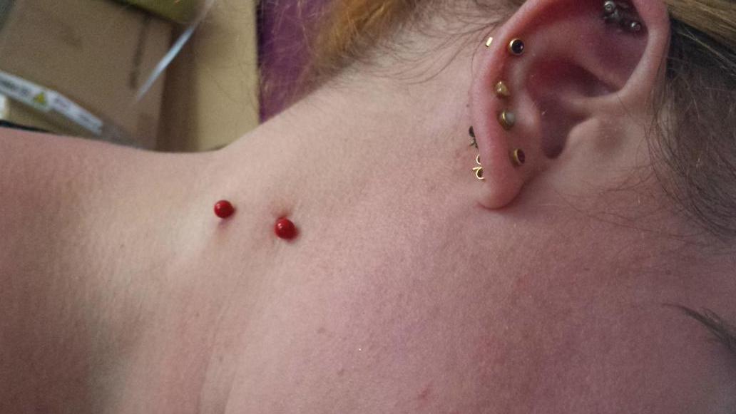 3c68a4dd7b034ac's tweet photo. @fluxpiercing thanks for changing my vampire bite. Love it 😊 http://t.co/yQNQGIsMAr