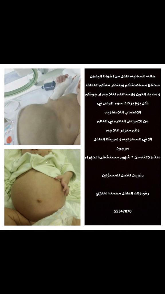 Tariqalessa1's tweet photo. @sarahsoo1990 
طفل من فئة البدون في الكويت محتاج علاج في السعوديه 
نسأل فاعلين الخيرلعلاجه
#ريتويت_للأجر http://t.co/2SwCdxhBom