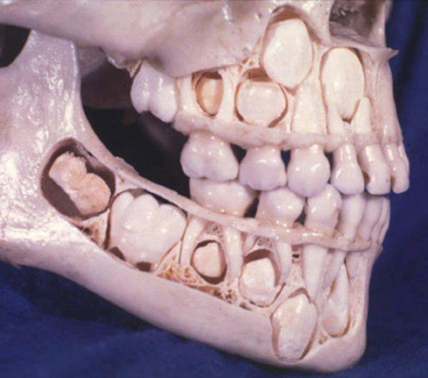 thoughts_'s tweet image. This is what a child's skull looks like before losing baby teeth..
