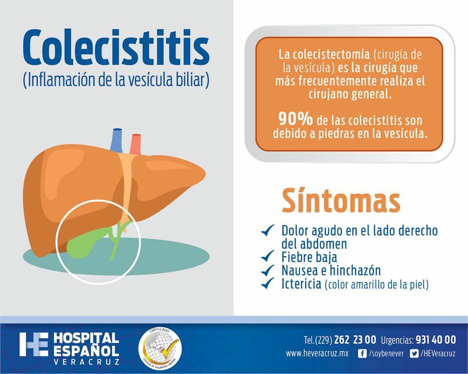 HEVeracruz's tweet photo. #colecistitis una de las causas más comunes de cirugía. Aprende a reconocerla y acude con tu médico #benever #salud http://t.co/YE6zByH1Dj