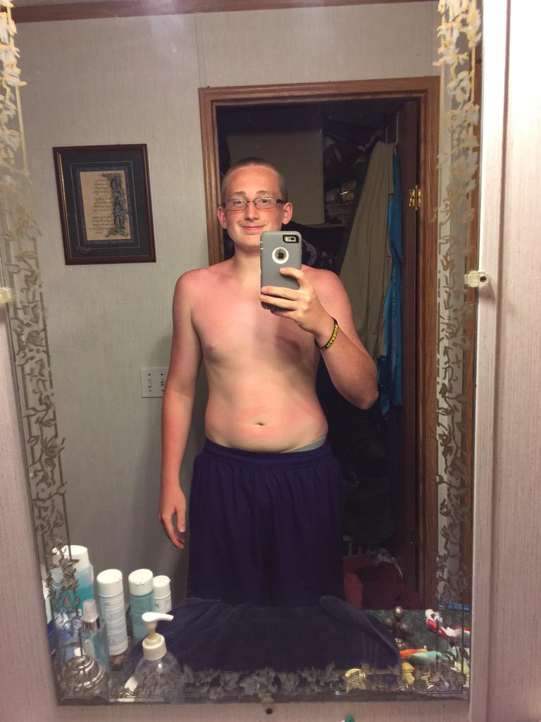 ozzyborn57's tweet photo. Done did got myself all burnt today #SixthTweet http://t.co/rqMfgOZAIC