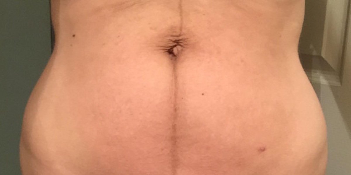 HuffPost's tweet photo. A Tale of 10 Tummies: 10 photographs of women's bellies http://t.co/QjtCEt3doc http://t.co/o9Z1levHrz