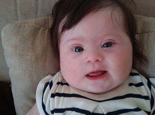 BuzzFeed's tweet photo. A mom shared the annoying things said about her daughter with Down Syndrome http://t.co/GjQioovvyL http://t.co/6pwTYDLLib