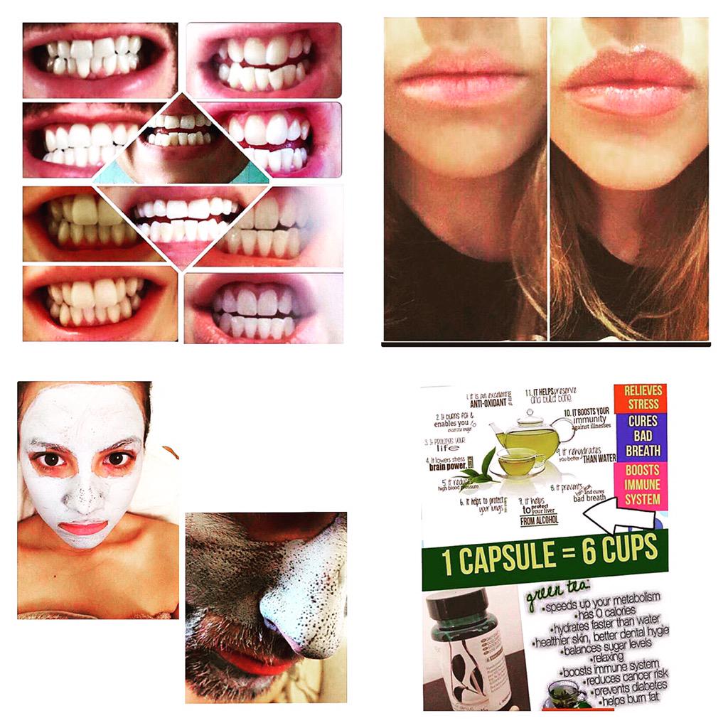 georgiadeex's tweet photo. OFFERS💕 great teeth whitening fluoride toothpaste that takes effect after 3 brushes and much more! Inbox for prices 👄 http://t.co/KM8gedgd8v